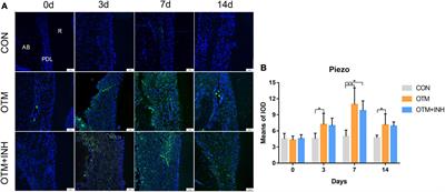 Mechanosensitive Piezo1 in Periodontal Ligament Cells Promotes Alveolar Bone Remodeling During Orthodontic Tooth Movement